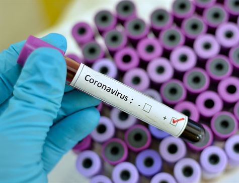 Sobem para 28 os casos confirmados do novo coronavírus em Pernambuco