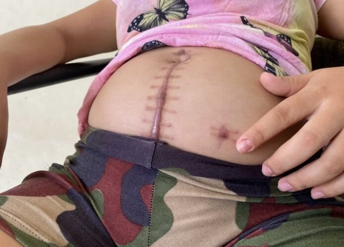 Jovem esfaqueada na barriga durante assalto descobriu gravidez após o crime; lâmina ficou a dois centímetros do bebê