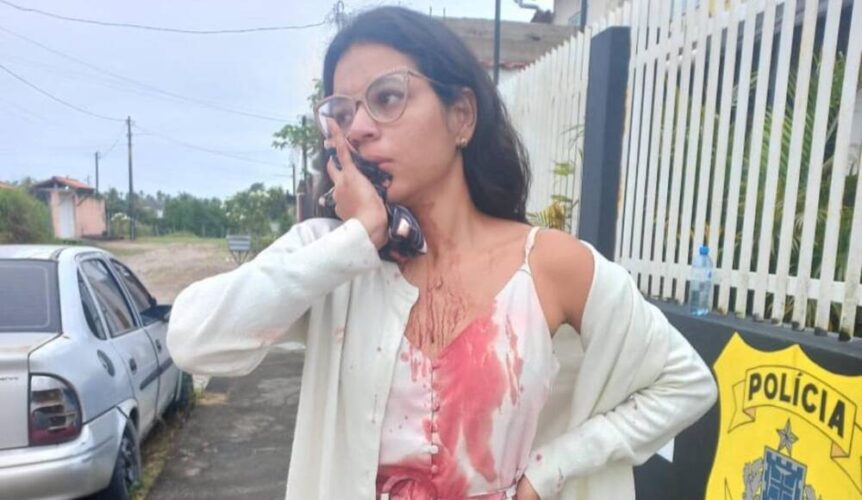 Mulher tem rosto esfaqueado enquanto dormia durante viagem de ônibus do Recife a Salvador